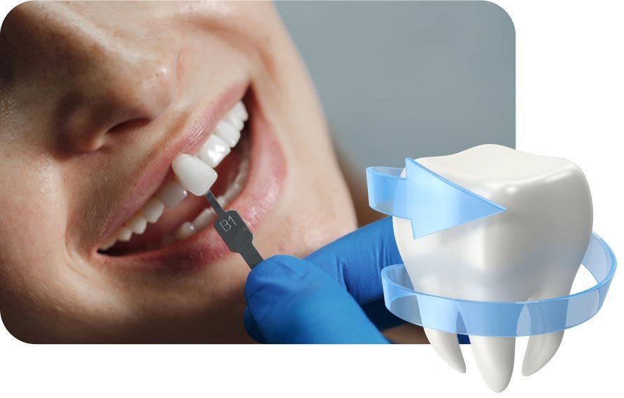 Servicios dentales en Barcelona